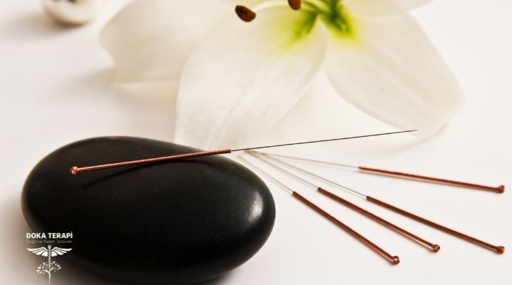 Akupunktur malzemeleri olan bir taşın yanında akupunktur iğneleri