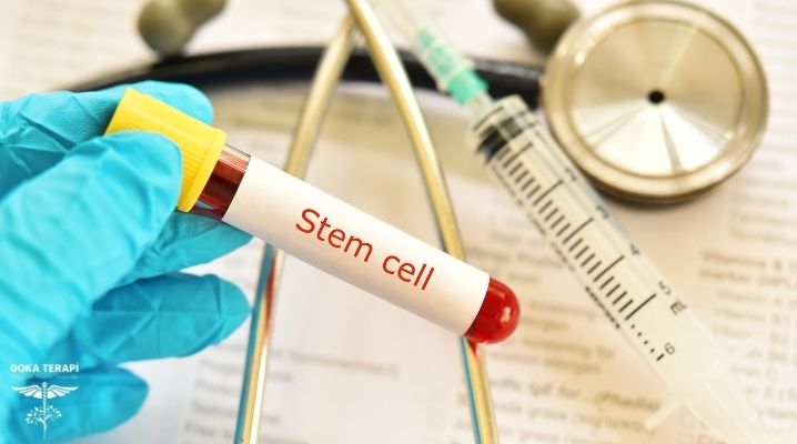 Kök hücre tedavisi yapan bir hekim ve elinde stem cell yazılı bir tüp