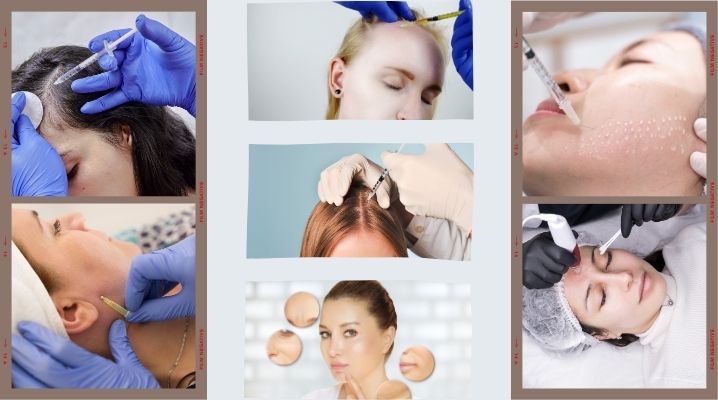 Üsküdar mezoterapi uygulama çeşitleri saç,yüz mezeoterapileri